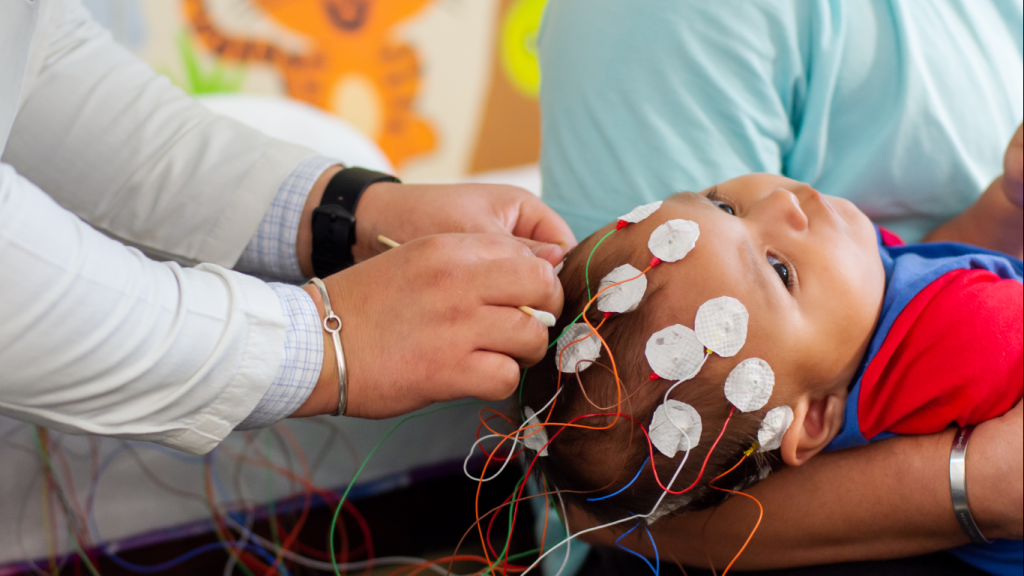 Criança fazendo EEG, para possivelmente diagnosticar síndromes epilépticas