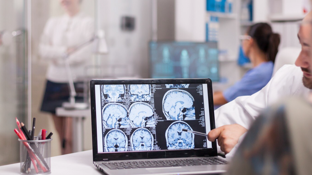 Médico analisando no notebook um eletroencefalograma (EEG)